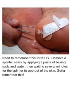 Easier Splinter Removal
