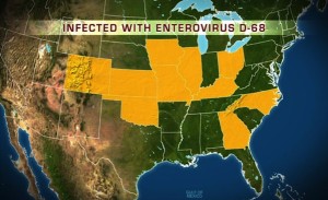 Enterovirus-D68-EV