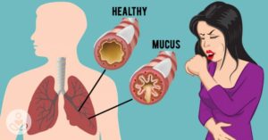 How-to-get-rid-of-mucus