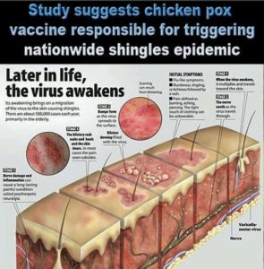 Shingles From Vaccine